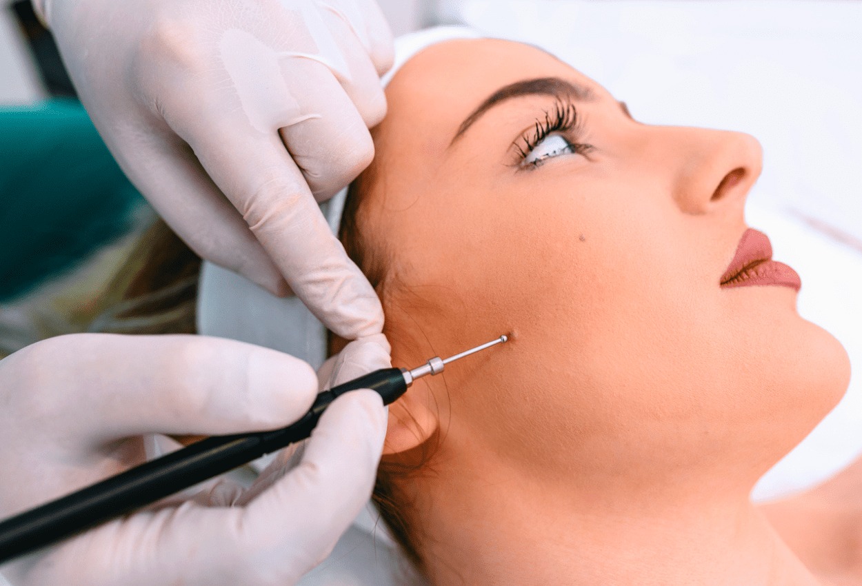 The Ultimate Guide to Botox: What You Need to Know Before Your First Treatment