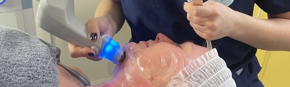 Exilis Skin Tightening