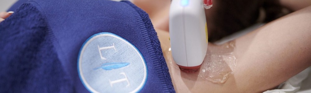 Laser Hair Removal