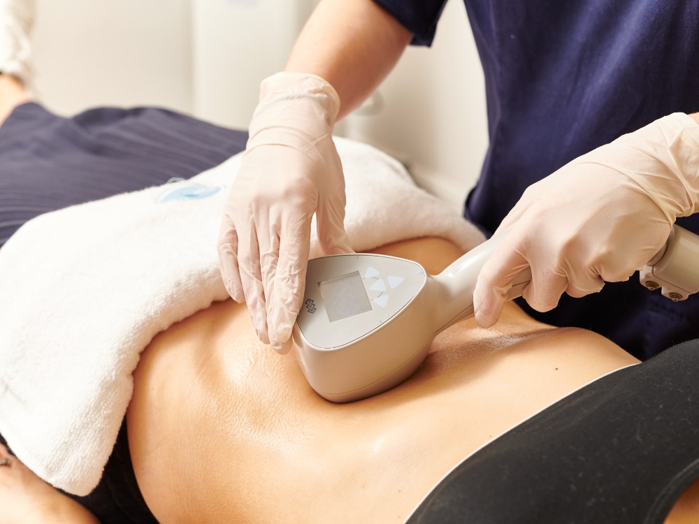 Exilis Elite Fat Removal