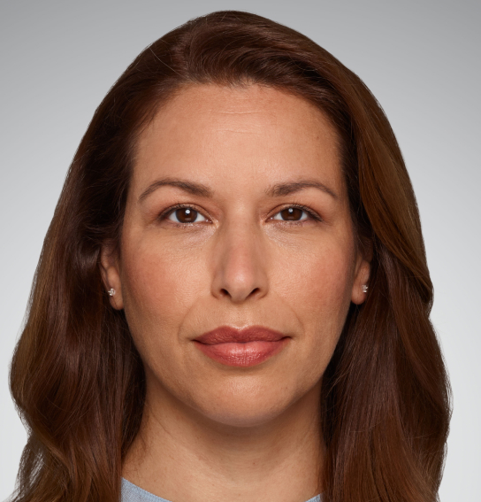 Before Dermal Fillers