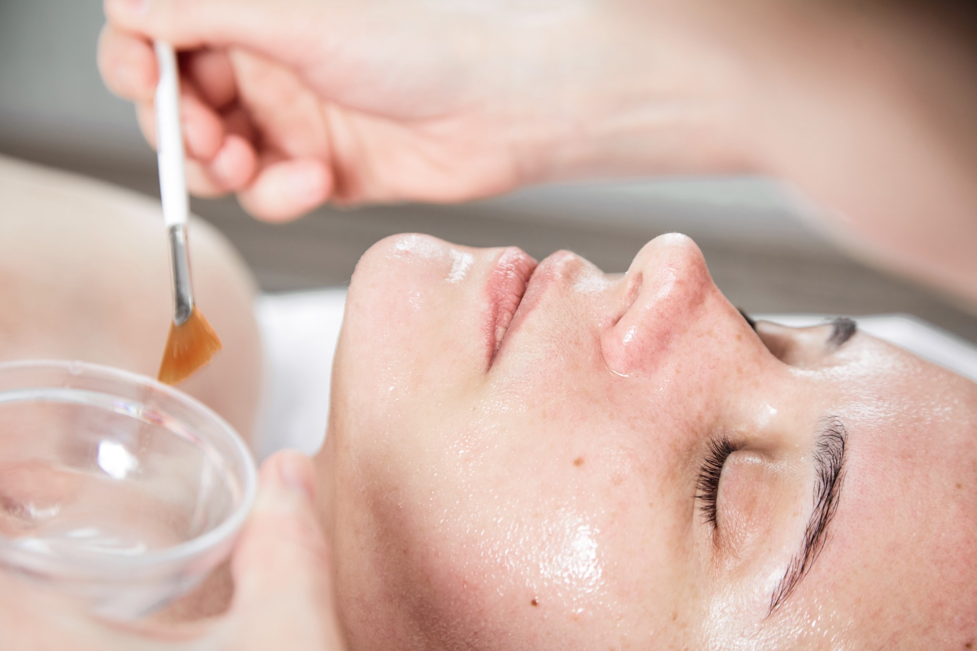 Facial Peel Facial Peel