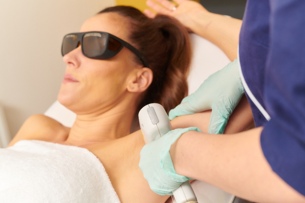 Laser Hair Removal