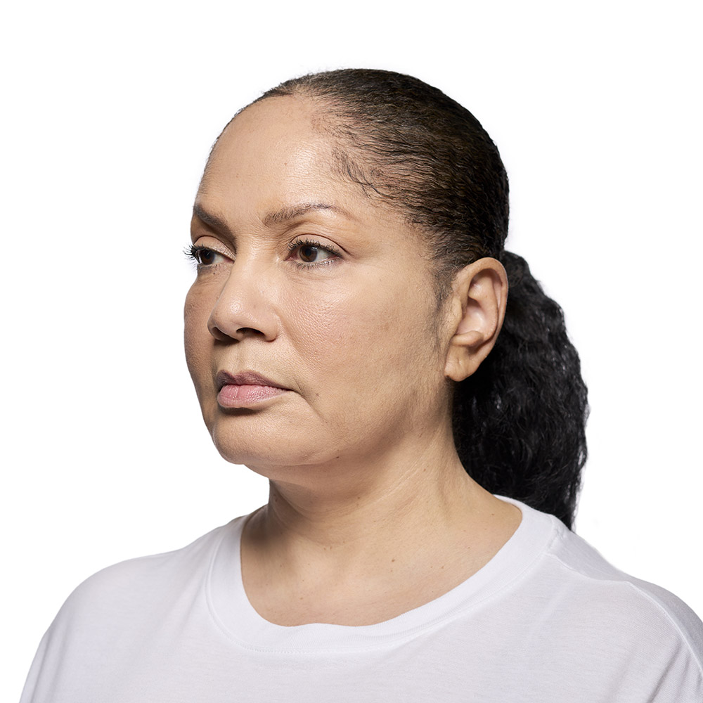 Robbyne Before Revanesse