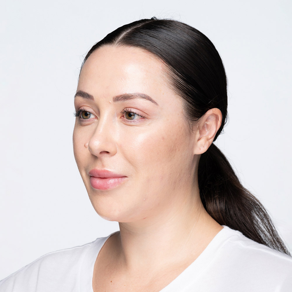 Shayli Before Revanesse