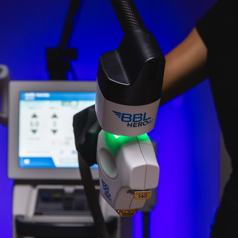 BBL HEROic Device BBL HEROic Device