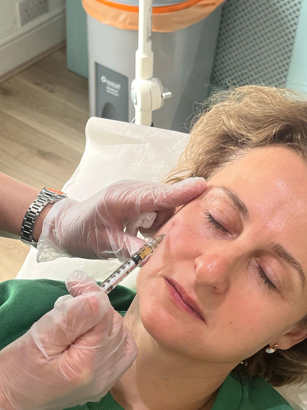 PRP under-eye treatment being administered.