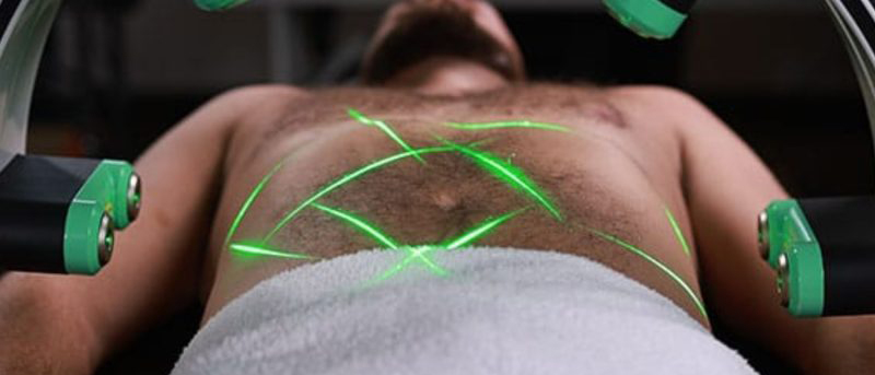 Man having emerald laser treatment